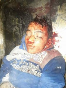 احد الشهداء الاطفال